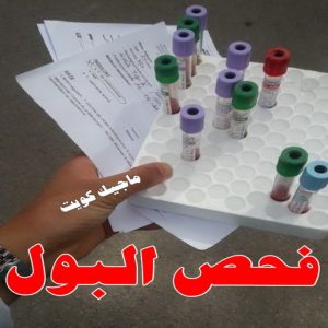 فحص البول