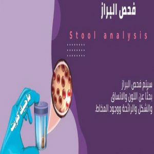 فحص البراز