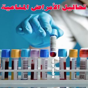 تحاليل الامراض المناعية