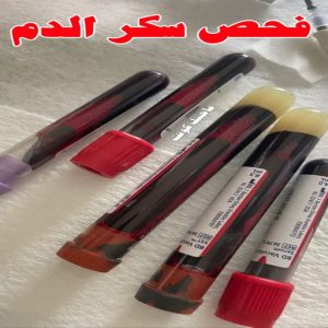 فحص سكر الدم